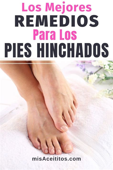 Los Mejores Remedios Para Pies Hinchados Caseros Y Naturales