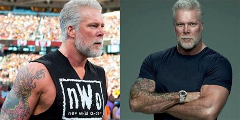 Wwe Hall Of Famer Kevin Nash To Undergo Neck Surgery