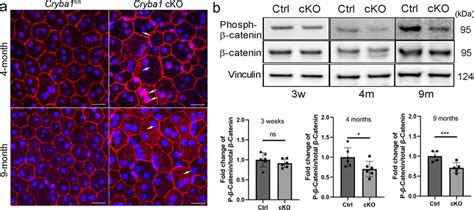 Activated β Catenin In Cryba1 Cko Rpe A Rpe Flatmounts Prepared From Download Scientific