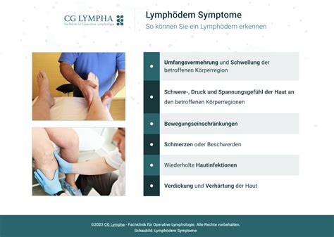 Lymph Dem Der Umfassende Ratgeber Cg Lympha