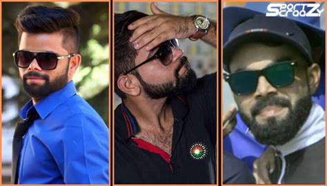 Virat Kohli Hair Transplant