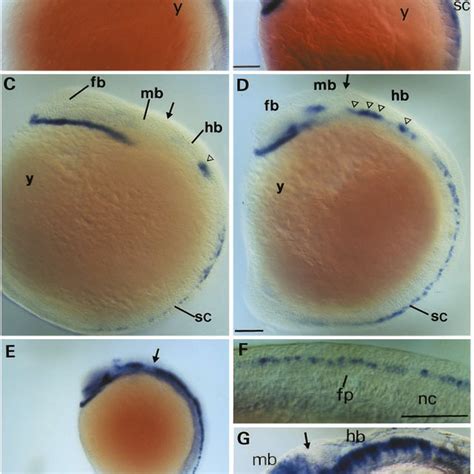 Whole Mount In Situ Hybridization Analysis Of Hlx 1 Expression Of