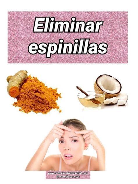 Pomada De C Rcuma Para Eliminar Espinillas Salud Y Belleza Natural