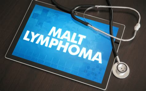 In The Know The Most Common 10 Symptoms Of Malt Lymphoma