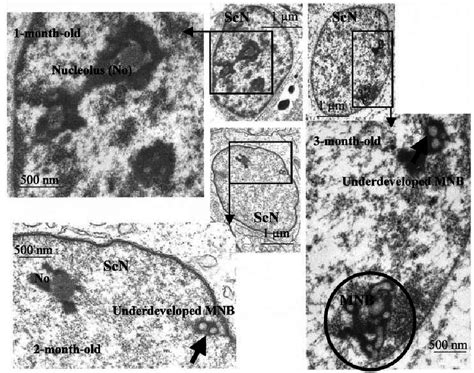 Transmission Electron Micrographs Showing The Sertoli Cell Nucleus At