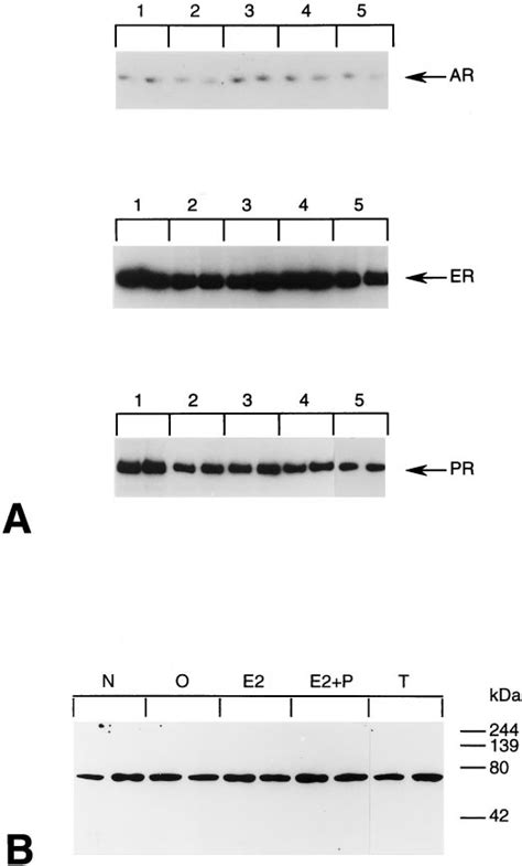 Pcr And Western Blot Of Sex Steroid Receptor In Mmq Cells Cultured In