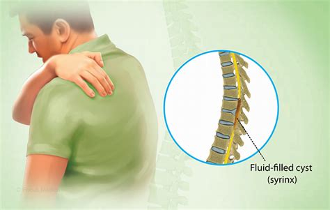 Health Condition : Symptoms, Causes, Treatment and More