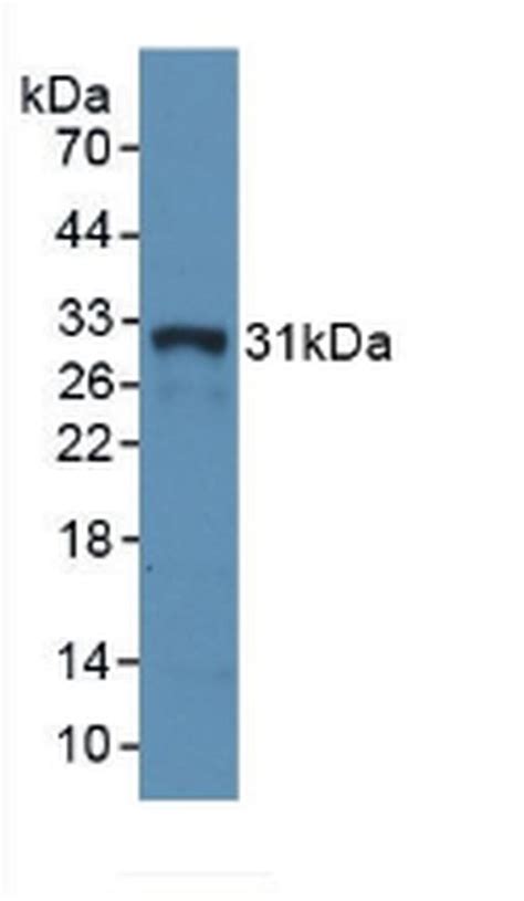 Hla Dra Polyclonal Antibody Pa5 119197