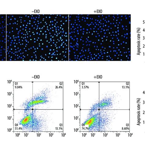 The Effect Of Rsc96 Schwann Cell Derived Exosomes On Apoptosis Of