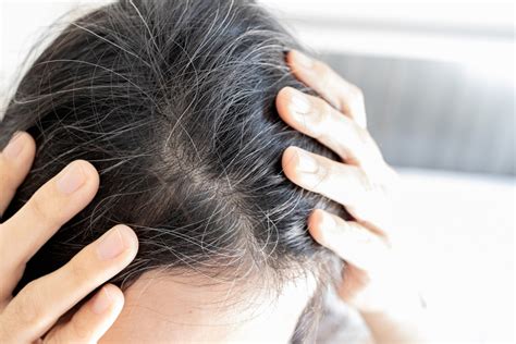 Why Does Hair Turn White: Causes and Prevention | Svenson