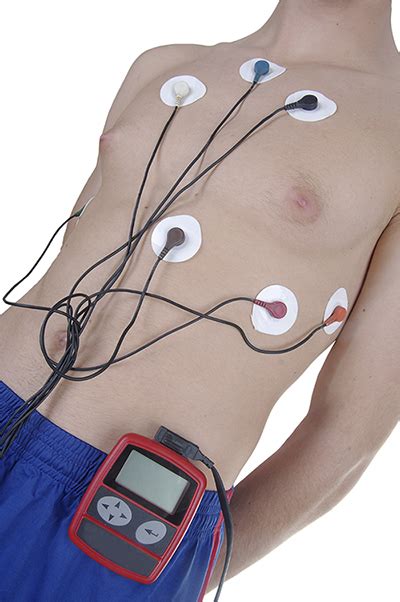 Trojanisches Pferd Gebühr Angemessen holter heart monitor abbrechen