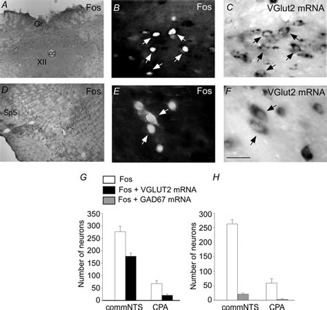 A B D E Photomicrographs Showing C Fos Expression In A B