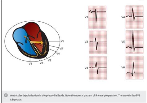 Ekgs Module Cb Flashcards Quizlet