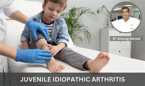 Juvenile Idiopathic Arthritis Symptoms Diagnosis And Treatment Dr Anurag Bansal