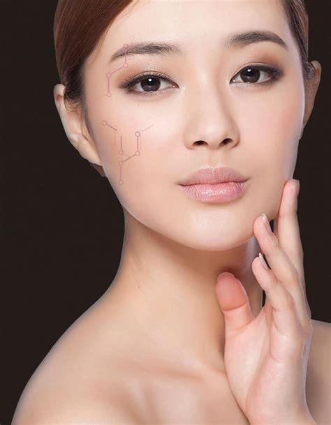 Venus Viva™ Acne Scar Removal – Cambridge Medical Group