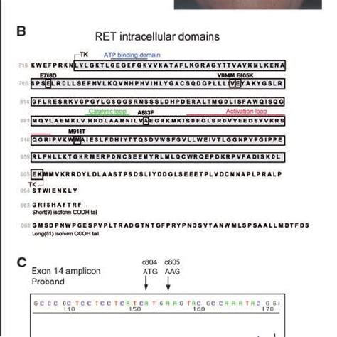 Clinical molecular genetics of the patient. A, pedigree of the MEN 2B... | Download Scientific ...