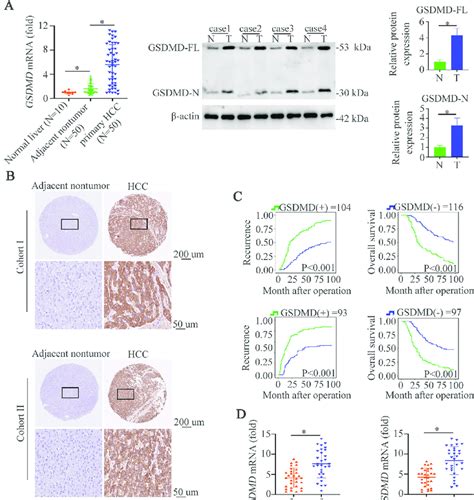 gsdmd   cleaved gsdmd   upregulated  hcc tissues