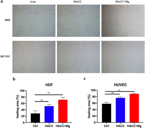 Results Of Cell Migration Assay In Vitro A Images Of Hdf And Huvec