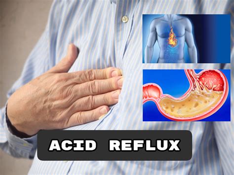 Help Acid Reflux with Apple Cider Vinegar! 100% Healthy - Apple Cider ...