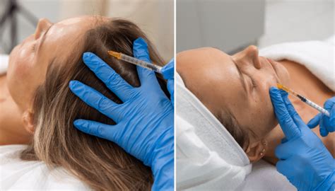 PRP Therapy The Secret To Hair Growth And Rejuvenation Ivory