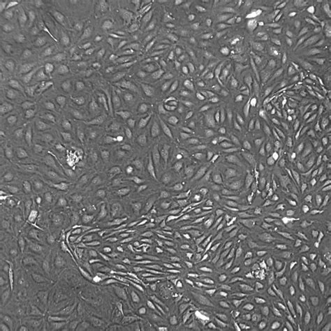 Dermal Microvascular Endothelial Cells Adult CellSystems