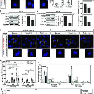 Autophagy Induction Dependent Gli Upregulation And Phosphorylation At