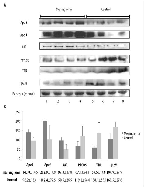 Verification Of The Expression Of Six Identified Proteins By Western Download Scientific