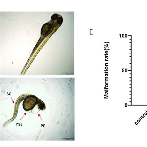 The morphology of zebrafish larvae. (A) control group; (B) 3.7*10 2 ...