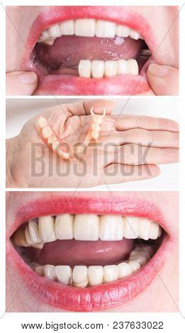 Dental Rehabilitation Image & Photo (Free Trial) | Bigstock