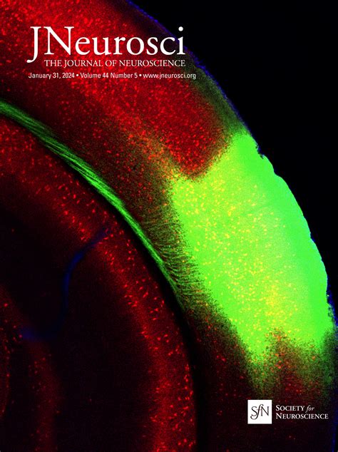 Amyloid Pathology Impairs Experience Dependent Inhibitory Synaptic