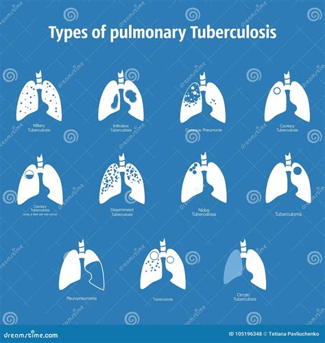 Types Of Tuberculosis Vector Silhouette Medical Illustration Of Human