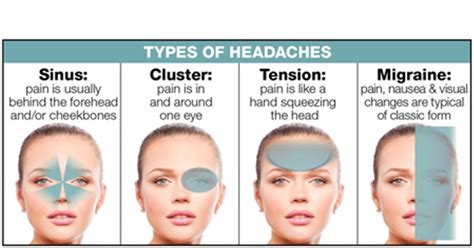 Headache on Top of Head: Main Causes Symptoms & Treatment - Clarendon ...