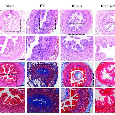 The H E A And Masson Trichrome B Staining Of Ft After Weeks