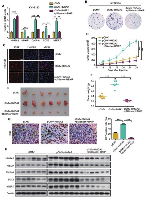 Stable Accumulation Of Oncogenic Hmga Mediated By Hbxip Promotes