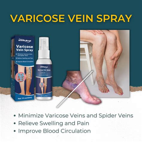 South Moon Varicose Vein Spray Minimize Varicose Veins And Spider