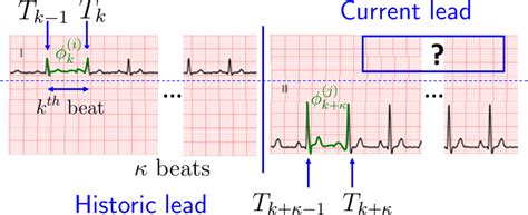 historic  current lead  divided  segments