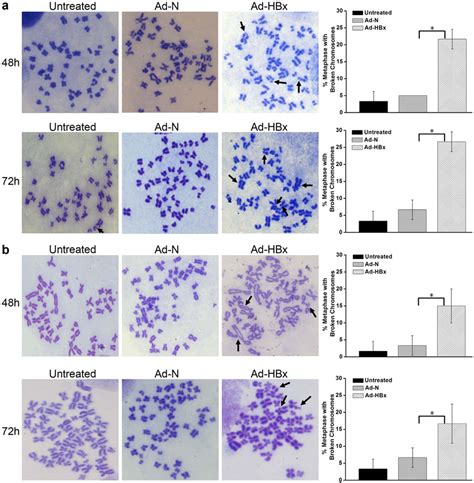 Hbx Induced Genomic Instability A B Chromosome Breaks In Hepg And