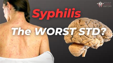 What Syphilis Does To The Body And Should You Get Tested Youtube