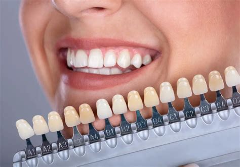 Which Teeth Shade Is Best A Guide To Choosing The Right Shade For Your