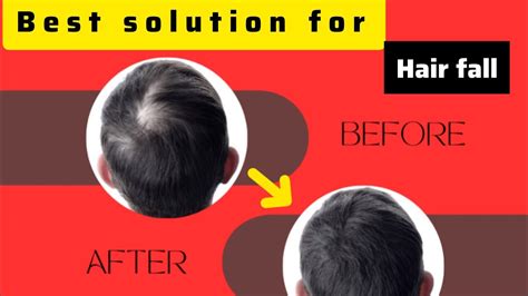 What The Solution For Hair Fall