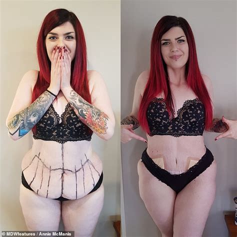 Incredible transformation of woman, 25, who had excess skin removed ...