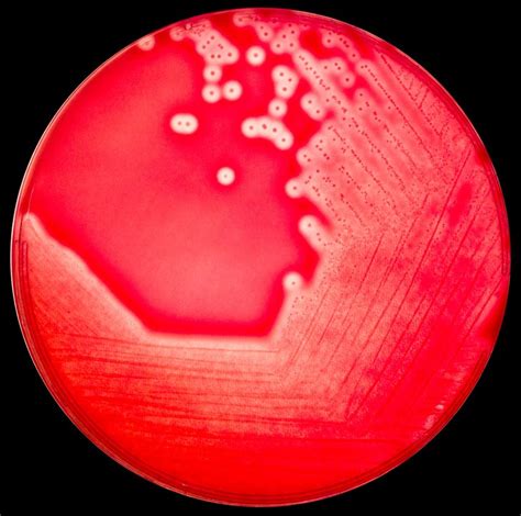 Streptococcus Pyogenes