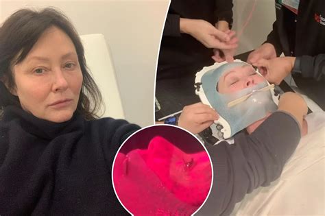 Shannen Doherty Shares Heartbreaking Cancer Update My Fear Is Obvious