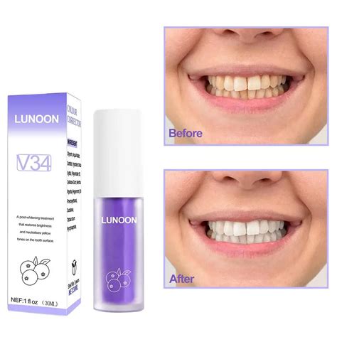 30ml Dental Remove Plaque Stains Care Toothpaste Tooth Purple V34 Color