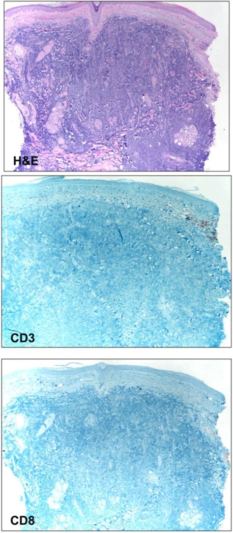 Photomicrographs 4 Magnification Of A Cutaneous Merkel Cell