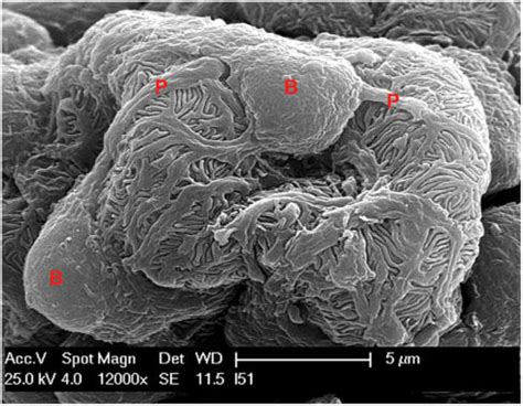 Podocyte structure. Scanning electron micrograph illustrating the... | Download Scientific Diagram