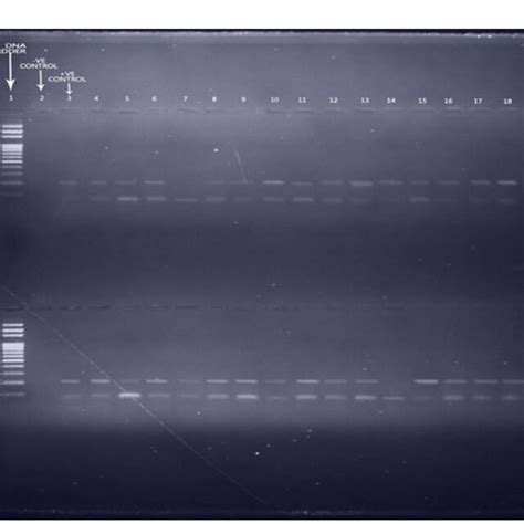 2 Agarose Gel Electrophoresis Analysis Of Plasmodium Falciparum Download Scientific Diagram