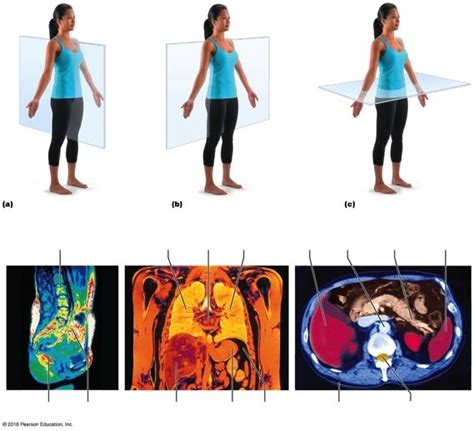body planes and sections Diagram | Quizlet