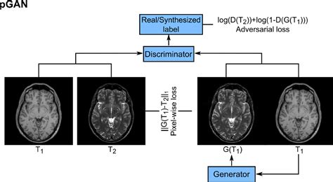 Figure From Image Synthesis In Multi Contrast Mri With Conditional