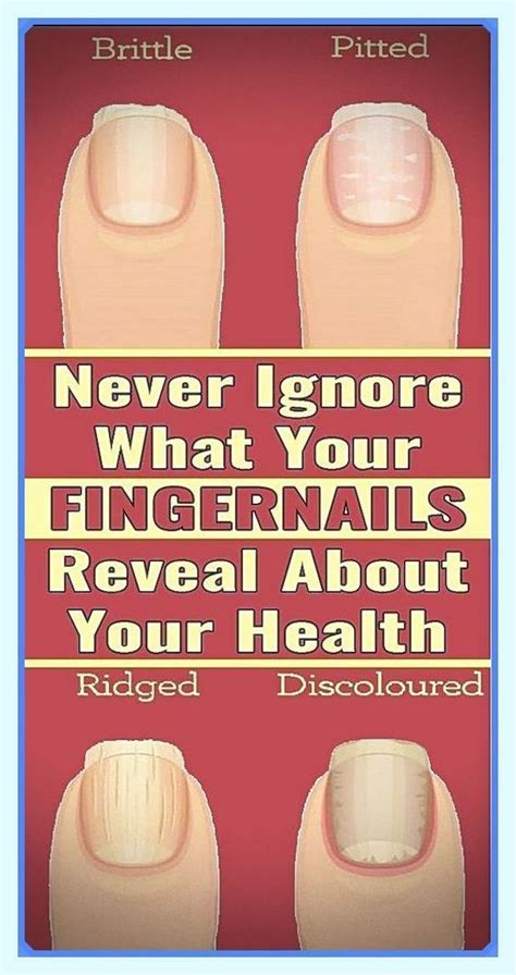 8 Important Signs Your Fingernails Can Tell About Your Health Artofit